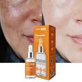 Sérum Facial Dermachem Vitamina C